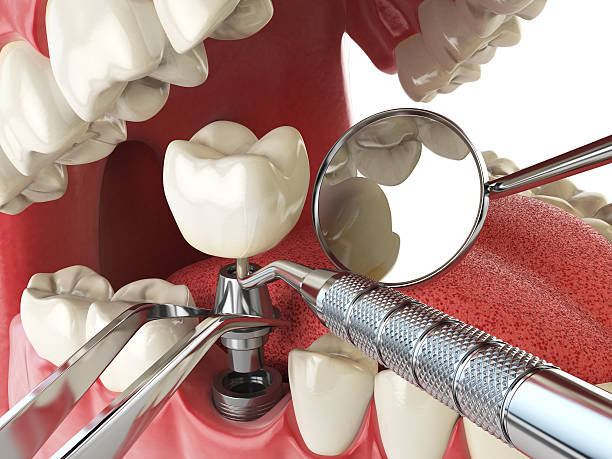 Best Emergency Dental Care for Trauma or Injury in Matoaca, VA